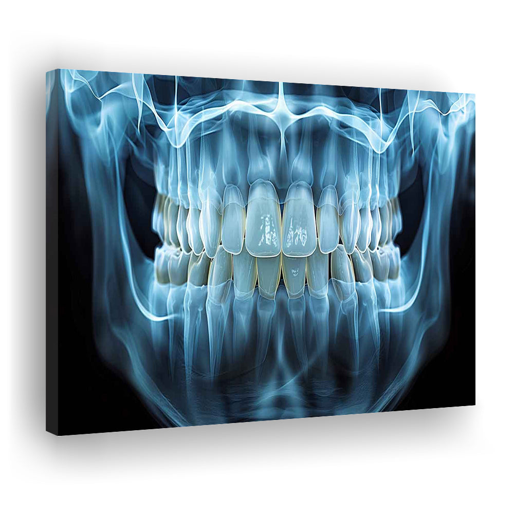 Panoramic X Ray Jaw Canvas Print, Snow white Healthy Teeth, Dental Office Decor, Cavas Print Wall Art Hom Decor