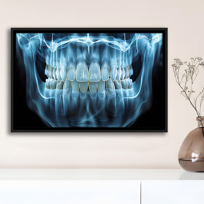 Panoramic X Ray Jaw Canvas Print, Snow White Healthy Teeth, Dental Office Decor, Framed Cavas Print, Floating Frame