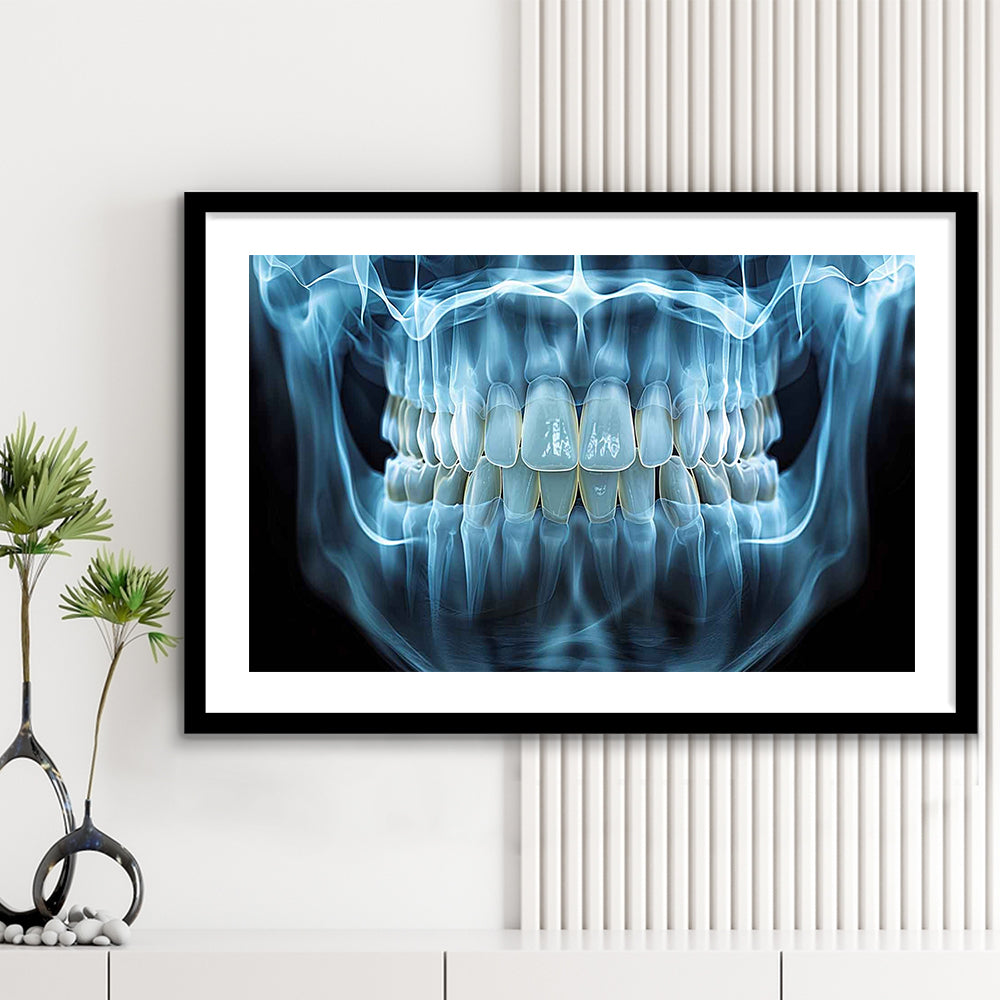Panoramic X Ray Jaw Art Print, Snow White Healthy Teeth, Dental Office Decor, Framed Art Print White Border