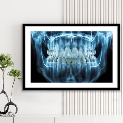 Panoramic X Ray Jaw Art Print, Snow White Healthy Teeth, Dental Office Decor, Framed Art Print White Border