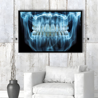 Panoramic X Ray Jaw Canvas Print, Snow White Healthy Teeth, Dental Office Decor, Framed Cavas Print, Floating Frame