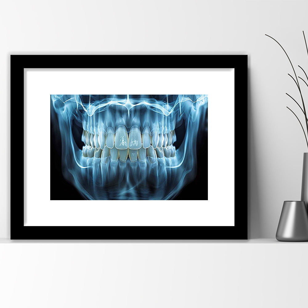 Panoramic X Ray Jaw Art Print, Snow White Healthy Teeth, Dental Office Decor, Framed Art Print White Border