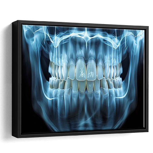 Panoramic X Ray Jaw Canvas Print, Snow White Healthy Teeth, Dental Office Decor, Framed Cavas Print, Floating Frame