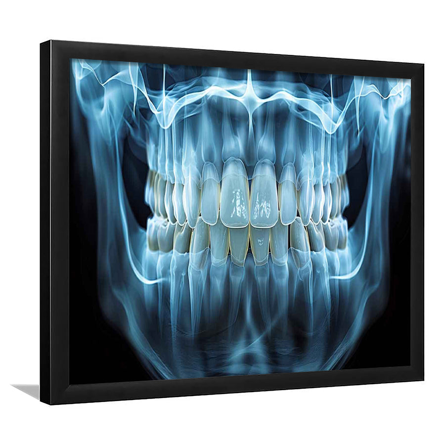 Panoramic X Ray Jaw Art Prints, Snow White Healthy Teeth, Dental Office Decor, Framed Art Print, Picture Framed