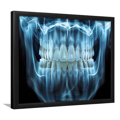 Panoramic X Ray Jaw Art Prints, Snow White Healthy Teeth, Dental Office Decor, Framed Art Print, Picture Framed