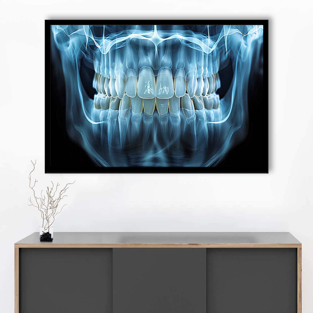 Panoramic X Ray Jaw Art Prints, Snow White Healthy Teeth, Dental Office Decor, Framed Art Print, Picture Framed