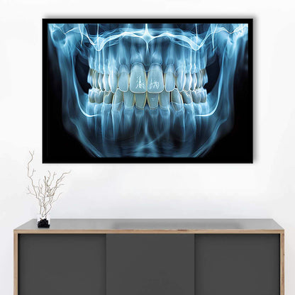 Panoramic X Ray Jaw Art Prints, Snow White Healthy Teeth, Dental Office Decor, Framed Art Print, Picture Framed
