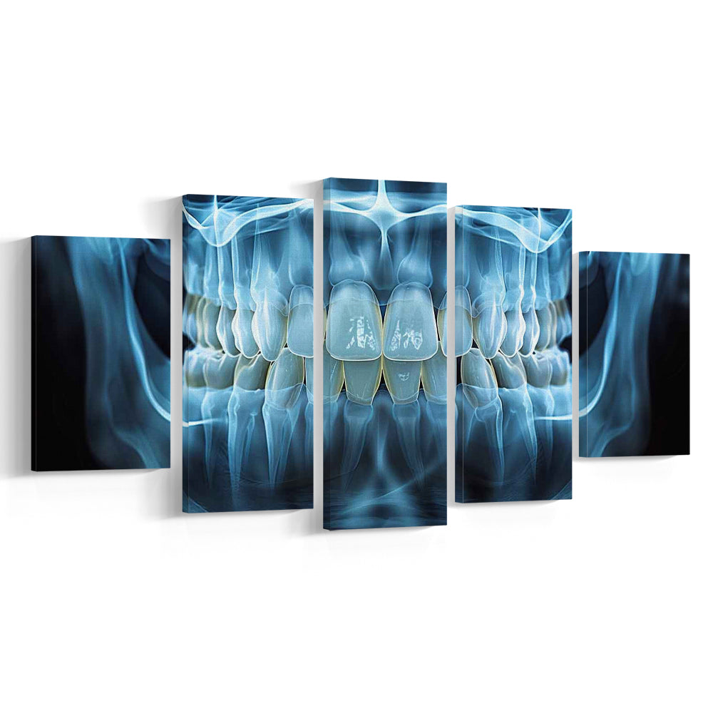Panoramic X Ray Jaw Canvas Print, Snow white Healthy Teeth, Dental Office Decor, 5 Piece Large Cavas Print Wall Art