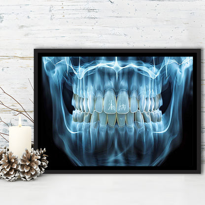 Panoramic X Ray Jaw Canvas Print, Snow White Healthy Teeth, Dental Office Decor, Framed Cavas Print, Floating Frame