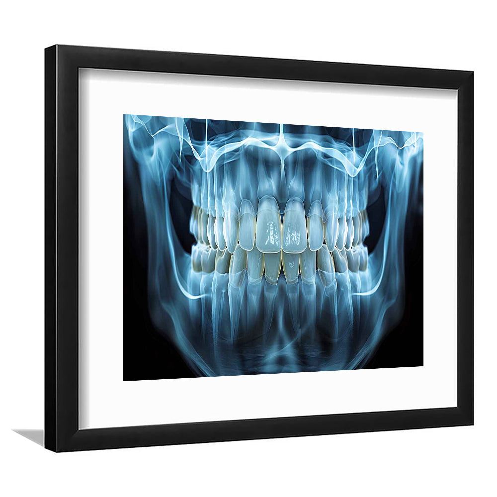 Panoramic X Ray Jaw Art Print, Snow White Healthy Teeth, Dental Office Decor, Framed Art Print White Border