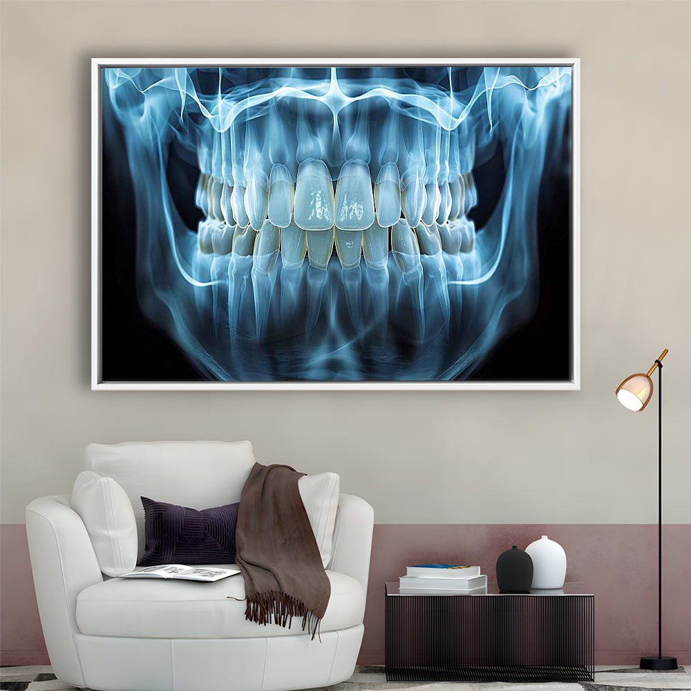 Panoramic X Ray Jaw Canvas Print, Snow White Healthy Teeth, Dental Office Decor, Framed Cavas Print, Floating Frame