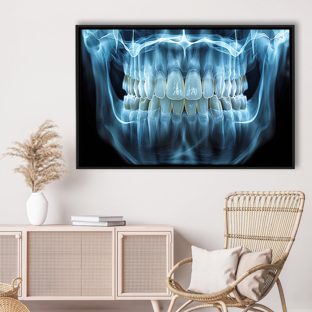 Panoramic X Ray Jaw Canvas Print, Snow White Healthy Teeth, Dental Office Decor, Framed Cavas Print, Floating Frame