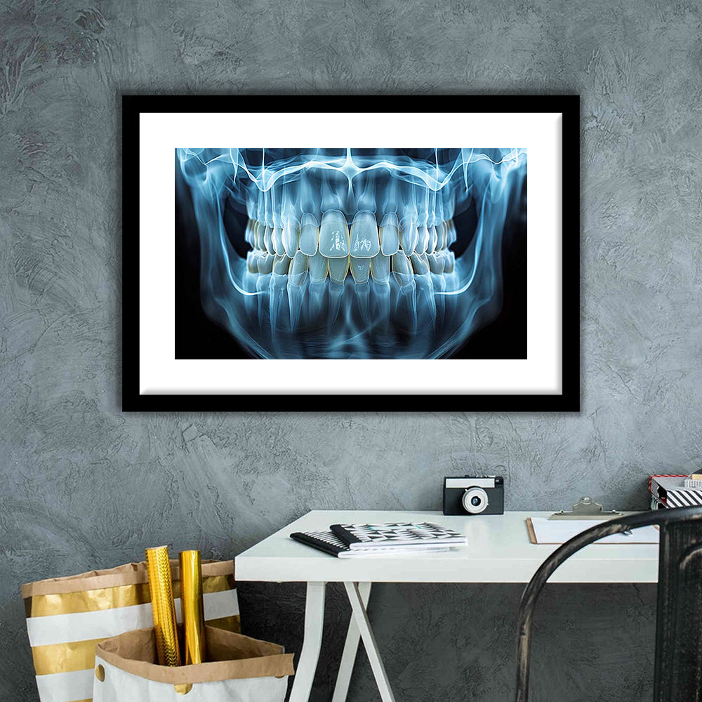 Panoramic X Ray Jaw Art Print, Snow White Healthy Teeth, Dental Office Decor, Framed Art Print White Border