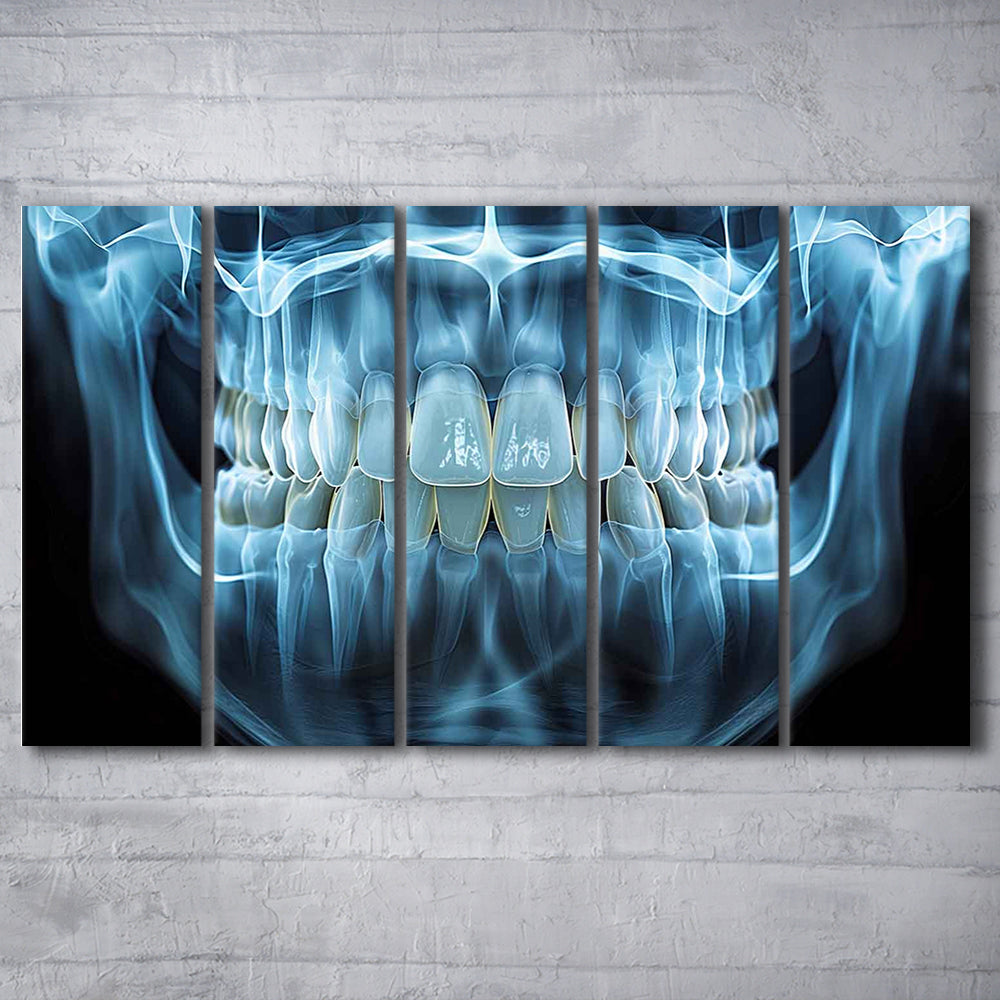 Panoramic X Ray Jaw Canvas Print, Snow white Healthy Teeth, Dental Office Decor, 5 Piece B Extra Large Cavas Print Wall Art