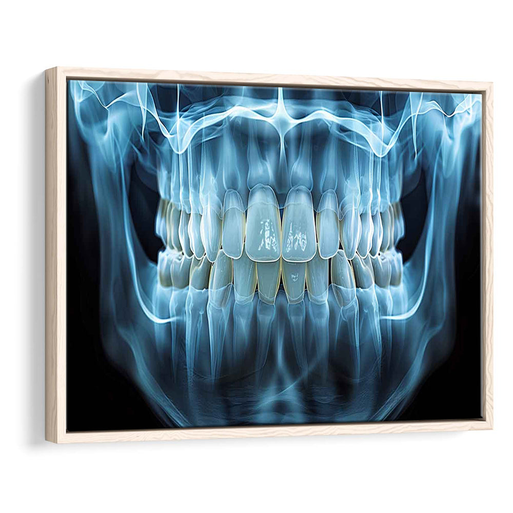 Panoramic X Ray Jaw Canvas Print, Snow White Healthy Teeth, Dental Office Decor, Framed Cavas Print, Floating Frame