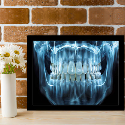 Panoramic X Ray Jaw Art Prints, Snow White Healthy Teeth, Dental Office Decor, Framed Art Print, Picture Framed