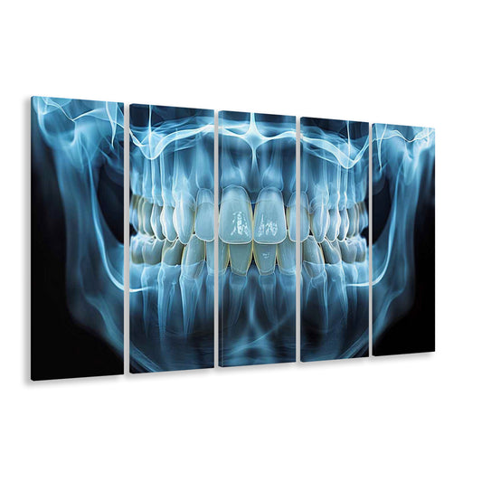 Panoramic X Ray Jaw Canvas Print, Snow white Healthy Teeth, Dental Office Decor, 5 Piece B Extra Large Cavas Print Wall Art